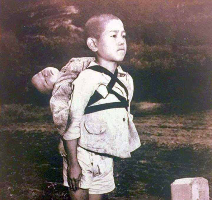 Ναγκασάκι 1945 παράπλευρες απώλειες. Ένα Γιαπωνεζόπουλο περιμένει να παραδώσει για αποτέφρωση τον νεκρό αδελφάκι του